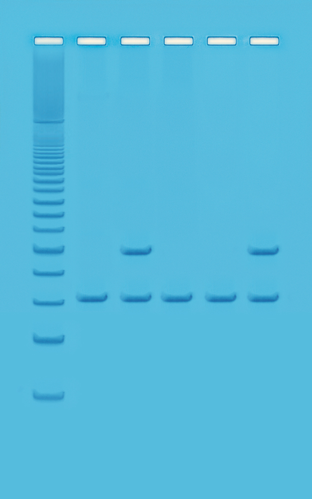 Alu-sekvens i mnskligt DNA - Edvotek