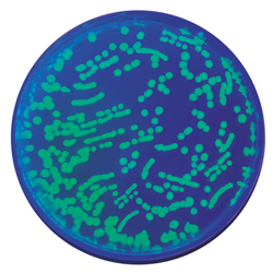 Transformation av E.coli m. fluorescerande protein - Edvotek